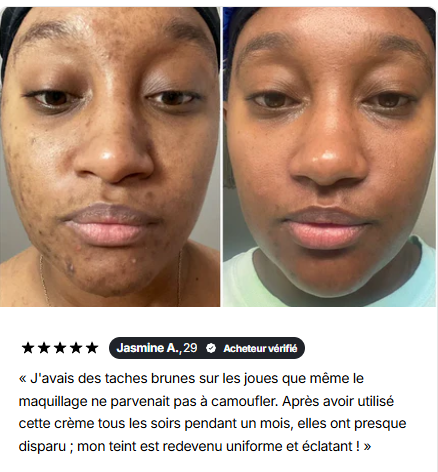 La crème anti-taches qui redonne éclat et confiance à votre peau