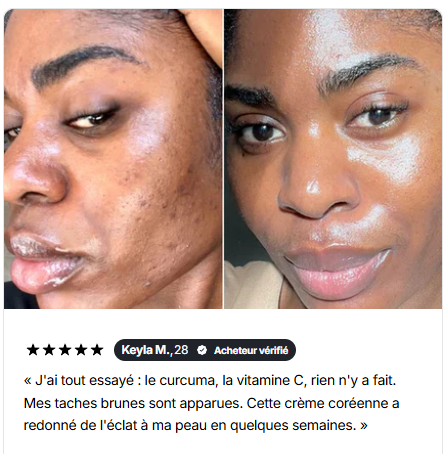 La crème anti-taches qui redonne éclat et confiance à votre peau
