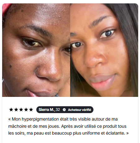 La crème anti-taches qui redonne éclat et confiance à votre peau